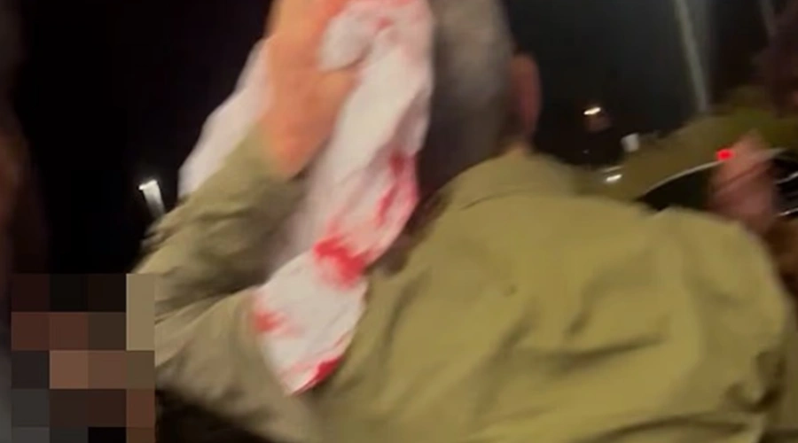 Nottingham Forest Sebut Pendukungnya Jadi Korban Penusukan Massal, Klub Janji Bantu Finasial